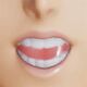Common Teeth.jpg
